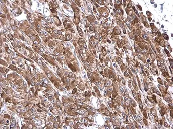 Anti-VASP antibody used in IHC (Paraffin sections) (IHC-P). GTX132176