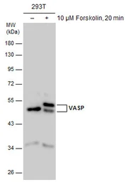 Anti-VASP antibody used in Western Blot (WB). GTX132176