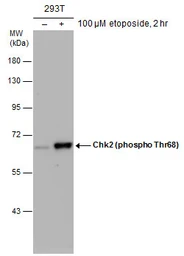Anti-Chk2 (phospho Thr68) antibody used in Western Blot (WB). GTX132204