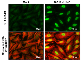 Anti-Chk2 (phospho Thr68) antibody used in Immunocytochemistry/ Immunofluorescence (ICC/IF). GTX132204