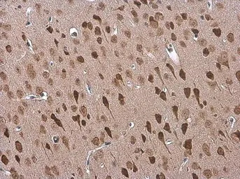 Anti-Adenosine A2b Receptor antibody used in IHC (Paraffin sections) (IHC-P). GTX132217