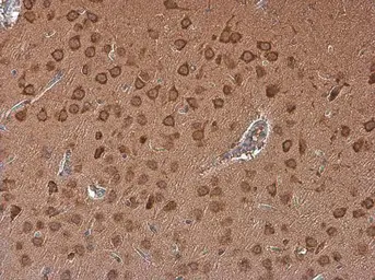 Anti-Adenosine A2b Receptor antibody used in IHC (Paraffin sections) (IHC-P). GTX132217