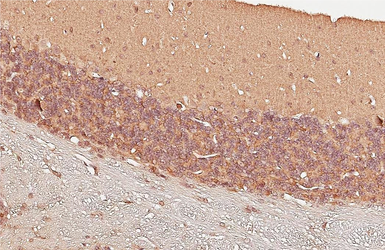 Anti-Adenosine A2b Receptor antibody used in IHC (Paraffin sections) (IHC-P). GTX132217