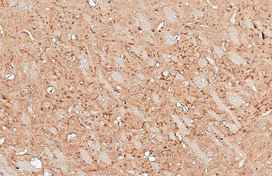 Anti-Adenosine A2b Receptor antibody used in IHC (Paraffin sections) (IHC-P). GTX132217