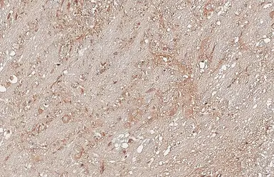Anti-Adenosine A2b Receptor antibody used in IHC (Paraffin sections) (IHC-P). GTX132217