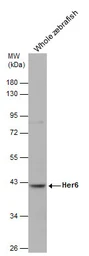 Anti-Her6 antibody used in Western Blot (WB). GTX132238