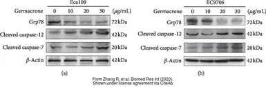 Anti-Caspase 12 antibody used in Western Blot (WB). GTX132298