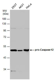 Anti-Caspase 12 antibody used in Western Blot (WB). GTX132298