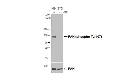 Anti-FAK (phospho Tyr407) antibody used in Western Blot (WB). GTX132320