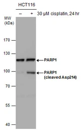 Anti-PARP antibody used in Western Blot (WB). GTX132329