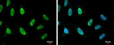Anti-PARP antibody used in Immunocytochemistry/ Immunofluorescence (ICC/IF). GTX132329