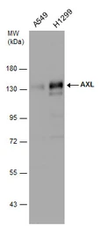 Anti-AXL antibody used in Western Blot (WB). GTX132386