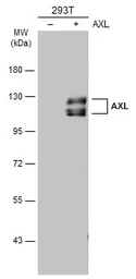 Anti-AXL antibody used in Western Blot (WB). GTX132386