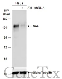 Anti-AXL antibody used in Western Blot (WB). GTX132387