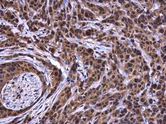 Anti-ATG101 antibody used in IHC (Paraffin sections) (IHC-P). GTX132435