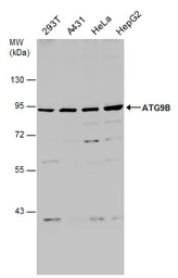 Anti-ATG9B antibody used in Western Blot (WB). GTX132439