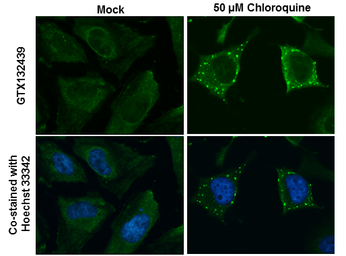 Anti-ATG9B antibody used in Immunocytochemistry/ Immunofluorescence (ICC/IF). GTX132439