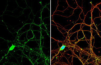 Anti-PYK2 antibody used in Immunocytochemistry/ Immunofluorescence (ICC/IF). GTX132447
