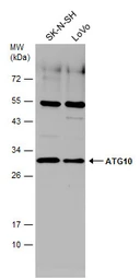 Anti-ATG10 antibody used in Western Blot (WB). GTX132449