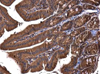Anti-PI3 kinase p150 antibody used in IHC (Paraffin sections) (IHC-P). GTX132466
