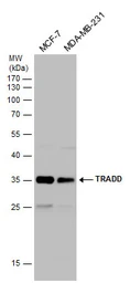 Anti-TRADD antibody used in Western Blot (WB). GTX132467