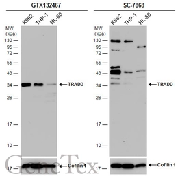 Anti-TRADD antibody used in Western Blot (WB). GTX132467