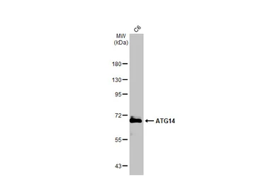 Anti-ATG14 antibody used in Western Blot (WB). GTX132468