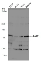 Anti-GASP1 antibody used in Western Blot (WB). GTX132469