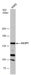 Anti-GASP1 antibody used in Western Blot (WB). GTX132469