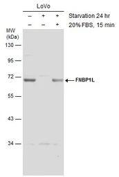 Anti-FNBP1L antibody used in Western Blot (WB). GTX132527
