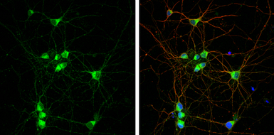 Anti-RAB7A antibody used in Immunocytochemistry/ Immunofluorescence (ICC/IF). GTX132548
