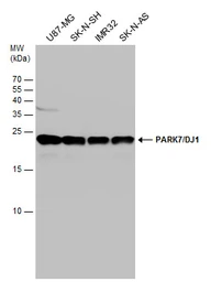 Anti-Park7 / DJ-1 antibody used in Western Blot (WB). GTX132552