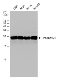 Anti-Park7 / DJ-1 antibody used in Western Blot (WB). GTX132552