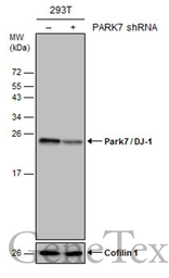 Anti-Park7 / DJ-1 antibody used in Western Blot (WB). GTX132552
