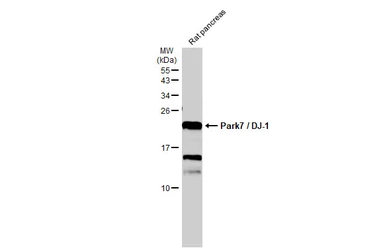 Anti-Park7 / DJ-1 antibody used in Western Blot (WB). GTX132552