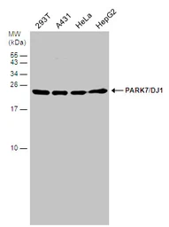 Anti-Park7 / DJ-1 antibody used in Western Blot (WB). GTX132556