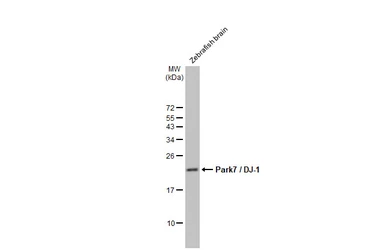 Anti-Park7 / DJ-1 antibody used in Western Blot (WB). GTX132556