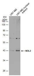 Anti-NEIL2 antibody used in Western Blot (WB). GTX132565