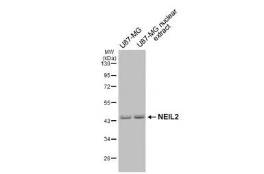 Anti-NEIL2 antibody used in Western Blot (WB). GTX132565