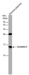 Anti-Cystatin C antibody used in Western Blot (WB). GTX132567