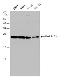 Anti-Park7 / DJ-1 antibody used in Western Blot (WB). GTX132574