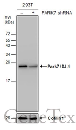Anti-Park7 / DJ-1 antibody used in Western Blot (WB). GTX132574