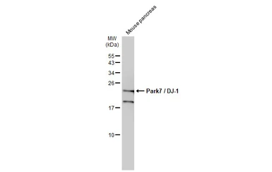 Anti-Park7 / DJ-1 antibody used in Western Blot (WB). GTX132574