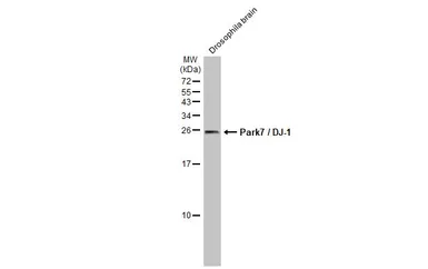 Anti-Park7 / DJ-1 antibody used in Western Blot (WB). GTX132574