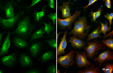 Anti-Park7 / DJ-1 antibody used in Immunocytochemistry/ Immunofluorescence (ICC/IF). GTX132574