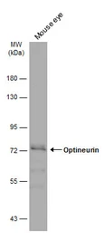 Anti-Optineurin antibody used in Western Blot (WB). GTX132575