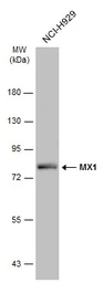 Anti-MX1 antibody used in Western Blot (WB). GTX132592