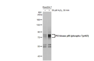 Anti-PI3 kinase p85 (phospho Tyr467)/p55 (phospho Tyr199) antibody used in Western Blot (WB). GTX132597
