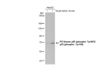 Anti-PI3 kinase p85 (phospho Tyr467)/p55 (phospho Tyr199) antibody used in Western Blot (WB). GTX132597