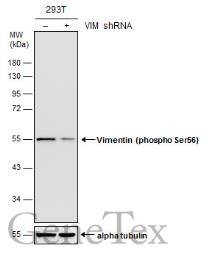 Anti-Vimentin (phospho Ser56) antibody used in Western Blot (WB). GTX132607
